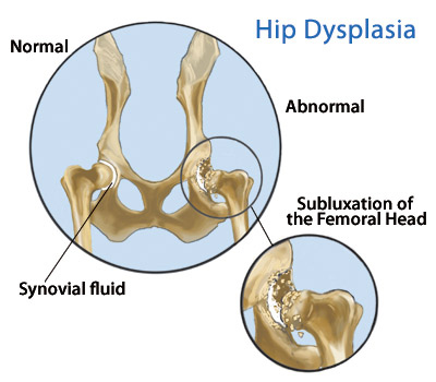 Hip dysplasia in dogs