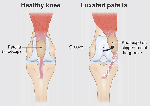 patellar luxation in small dogs