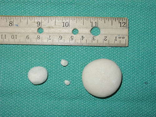 pictures of dog kidney stones